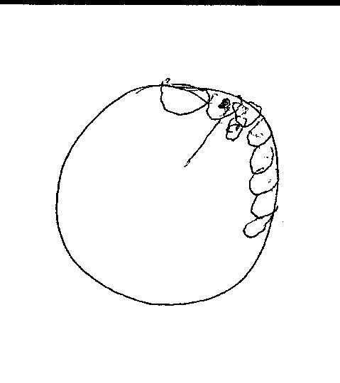 479x540 Clock Of The Week A Man Of Trump's Age Concussion Assessment