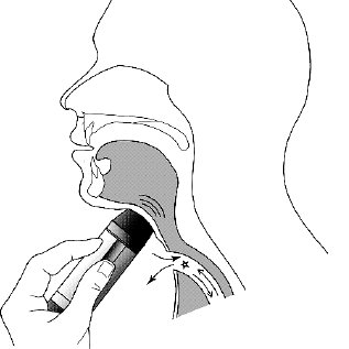 317x317 Example Of The Visual Sort And Rate (Visor) Method With Vertically