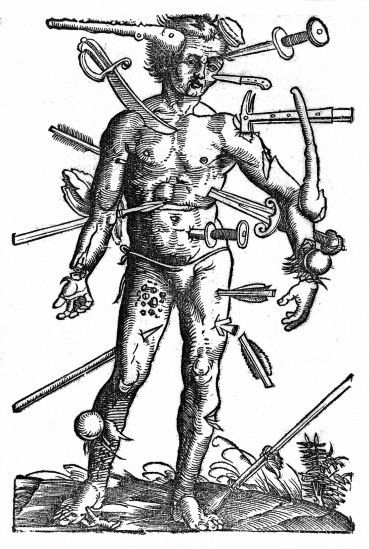 369x549 20 Best Medieval Wounds Images On Black Death, Middle