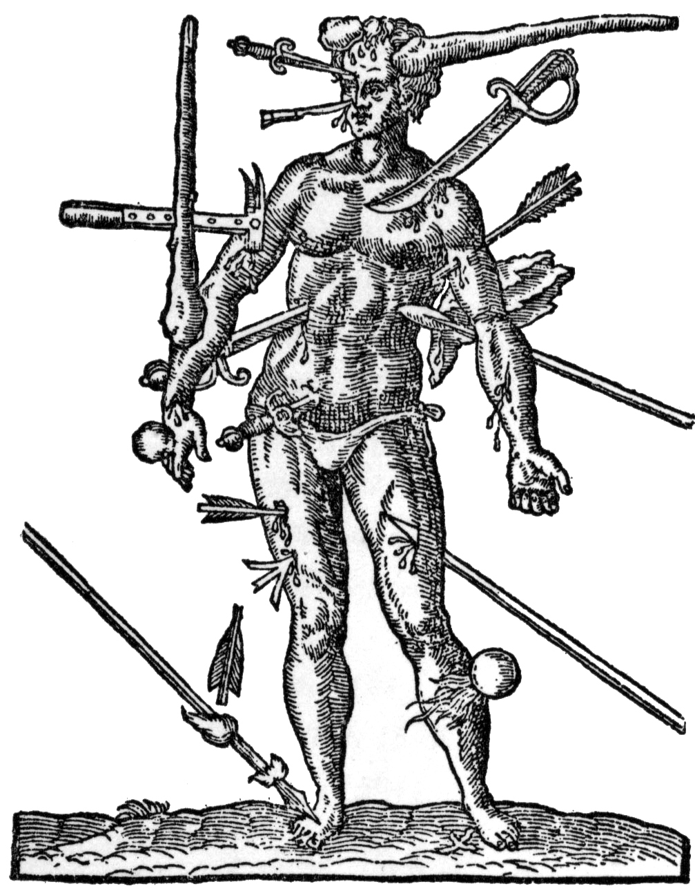 1007x1290 Filewounds Man.jpg