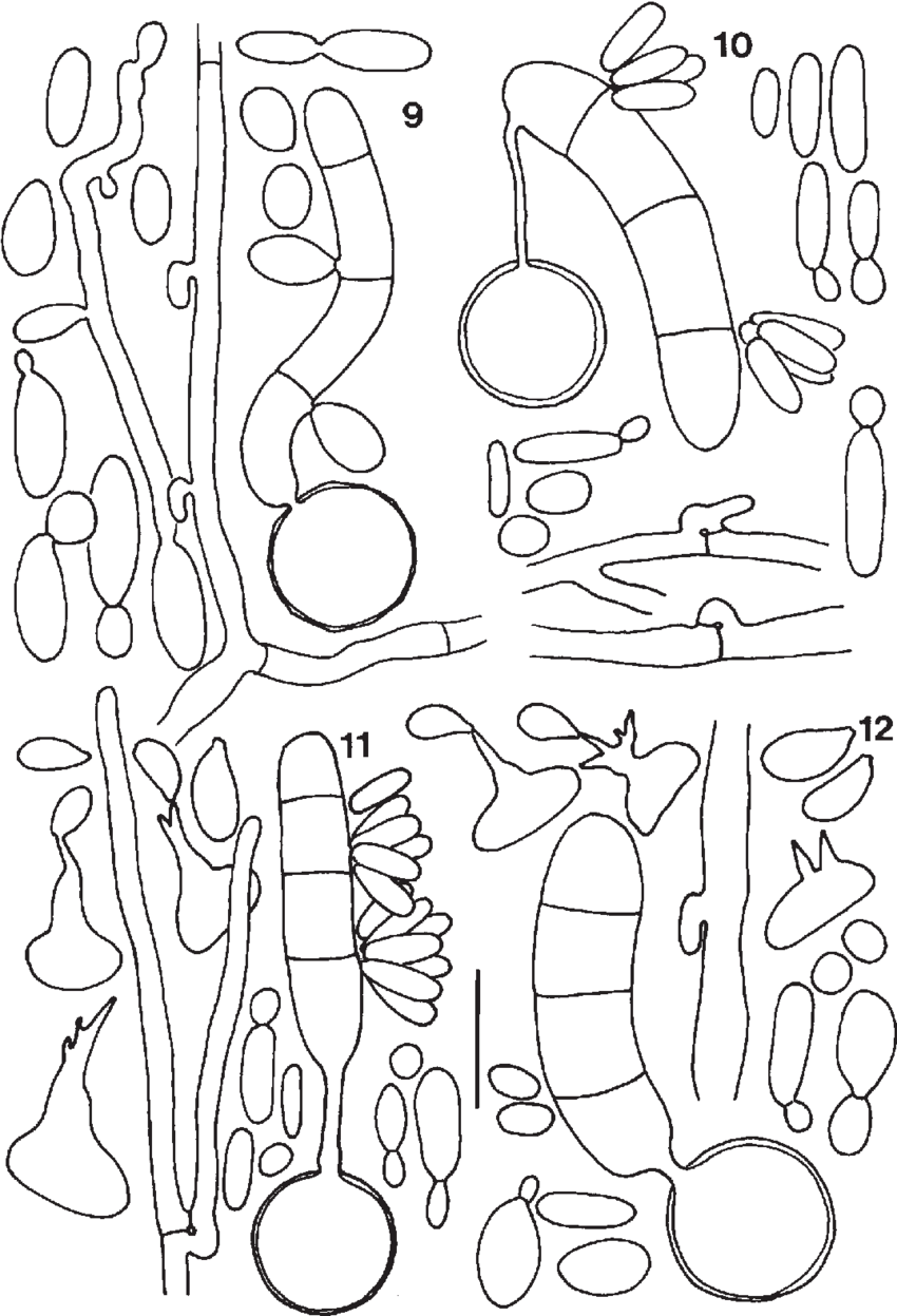 850x1247 Line Drawings Of Salient Features (Yeast Cells, Hyphae