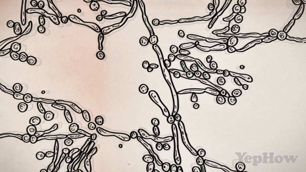 1280x720 Yeast Infection In Plain English