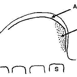 266x266 Pectoral Fin Development In The Zebrafish. The Single