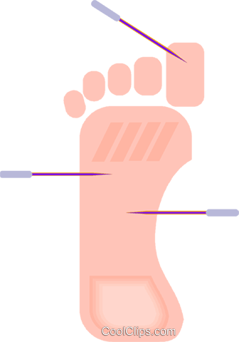 336x480 Acupuncture Royalty Free Vector Clip Art Illustration Vc009143