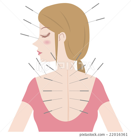 450x468 Vector, Vectors, Needle Acupuncture
