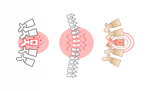 626x381 Back Pain Vector Illustration With Red Circle. Vector Premium