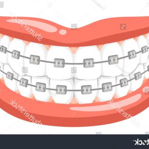 300x300 Big Smile Dental Braces Vector Cartoon Sohadacouri