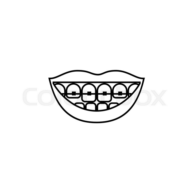 800x800 Teeth Braces Vector Line Icon Isolated On White Background. Teeth
