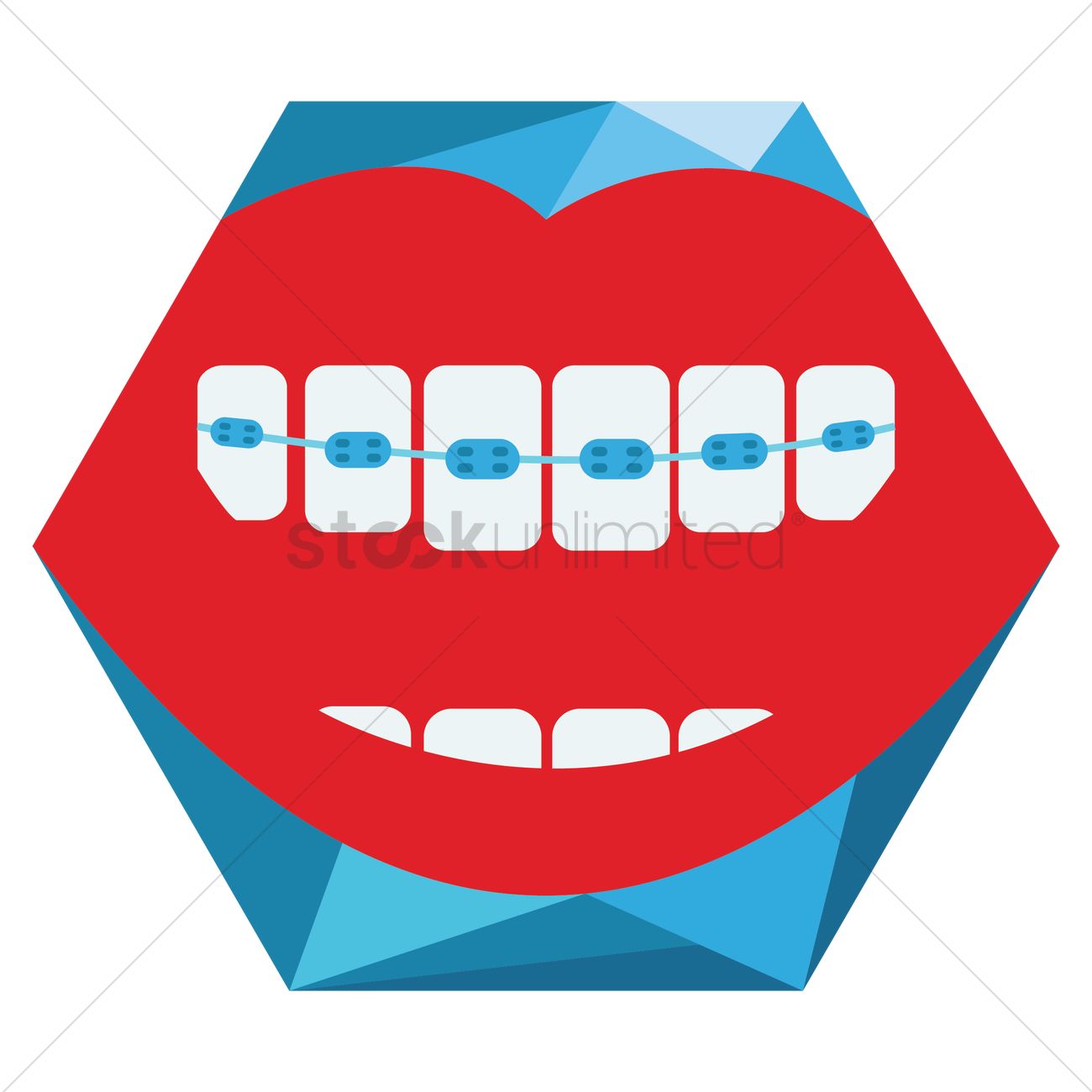 1300x1300 Teeth With Braces Vector Image