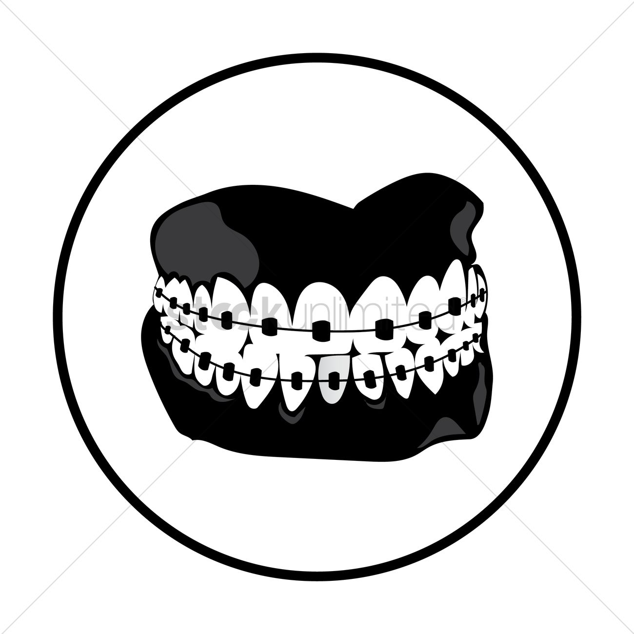 1300x1300 Teeth With Braces Vector Image
