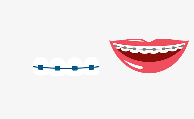 650x400 Vector Material Braces, Vector Material, Braces, Correct Png And