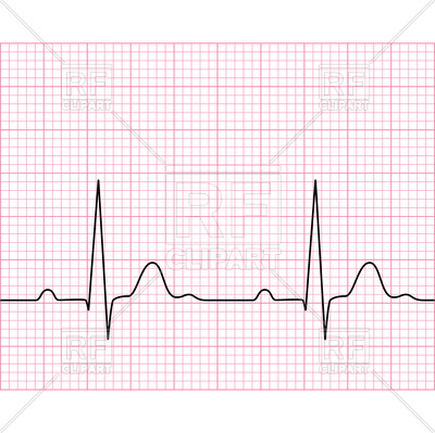 400x399 Medical Electrocardiogram