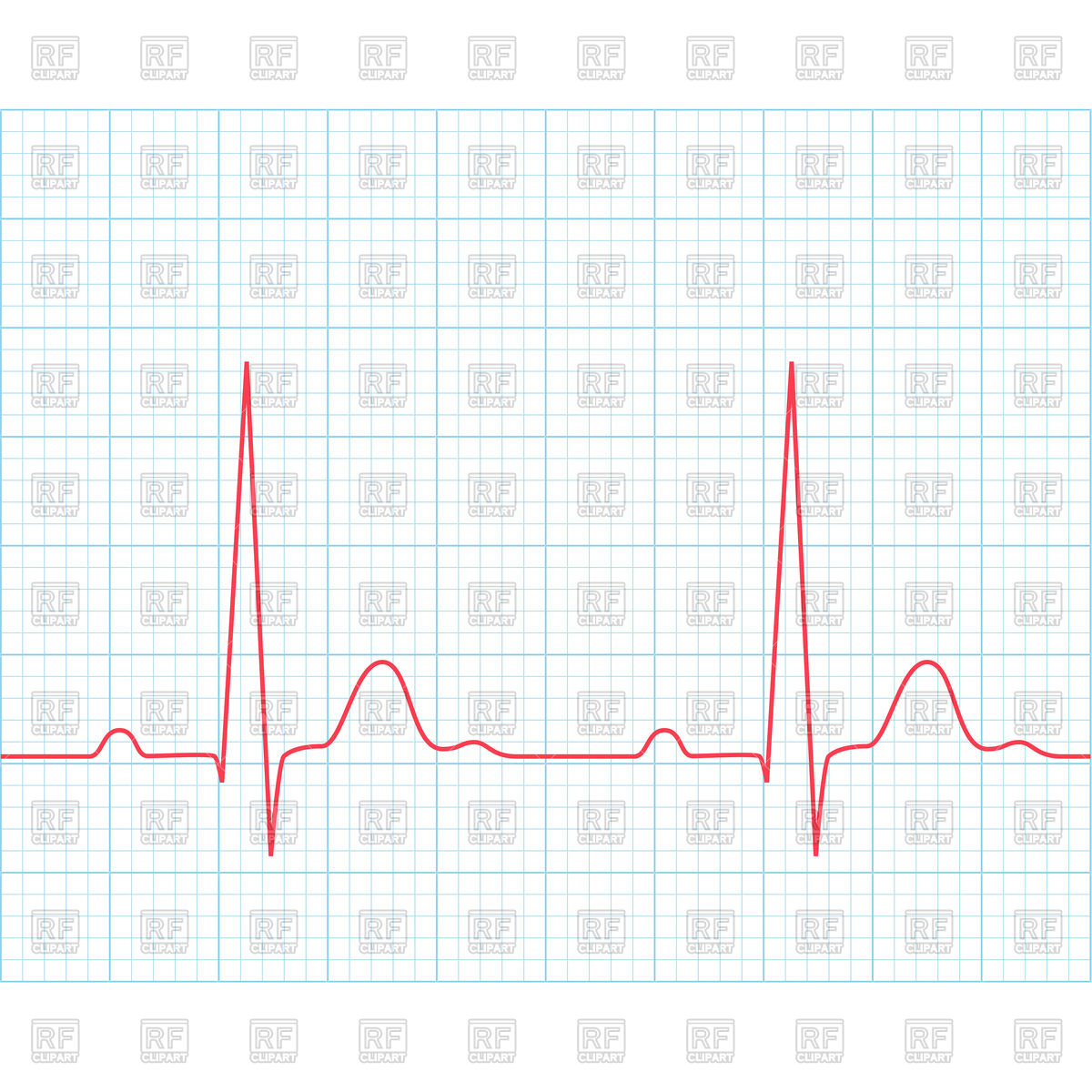 1200x1200 Medical Electrocardiogram