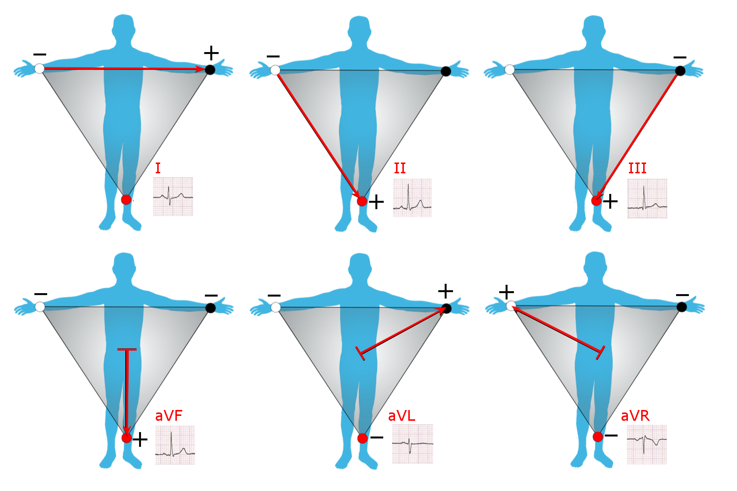 1500x1000 Electricity