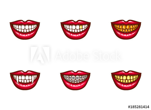 500x364 Set Of Vector Red Female Lips With White Healthy Teeth And Perfect