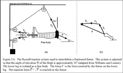 420x250 The Pulley Positions Are Adjusted So That The Vect
