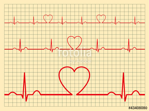 500x373 Heart Monitor Vector Stock Image And Royalty Free Vector Files On