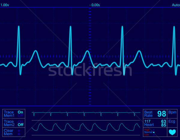 600x469 Heart Monitor Screen Vector Illustration Dan Ionut Popescu (Dip