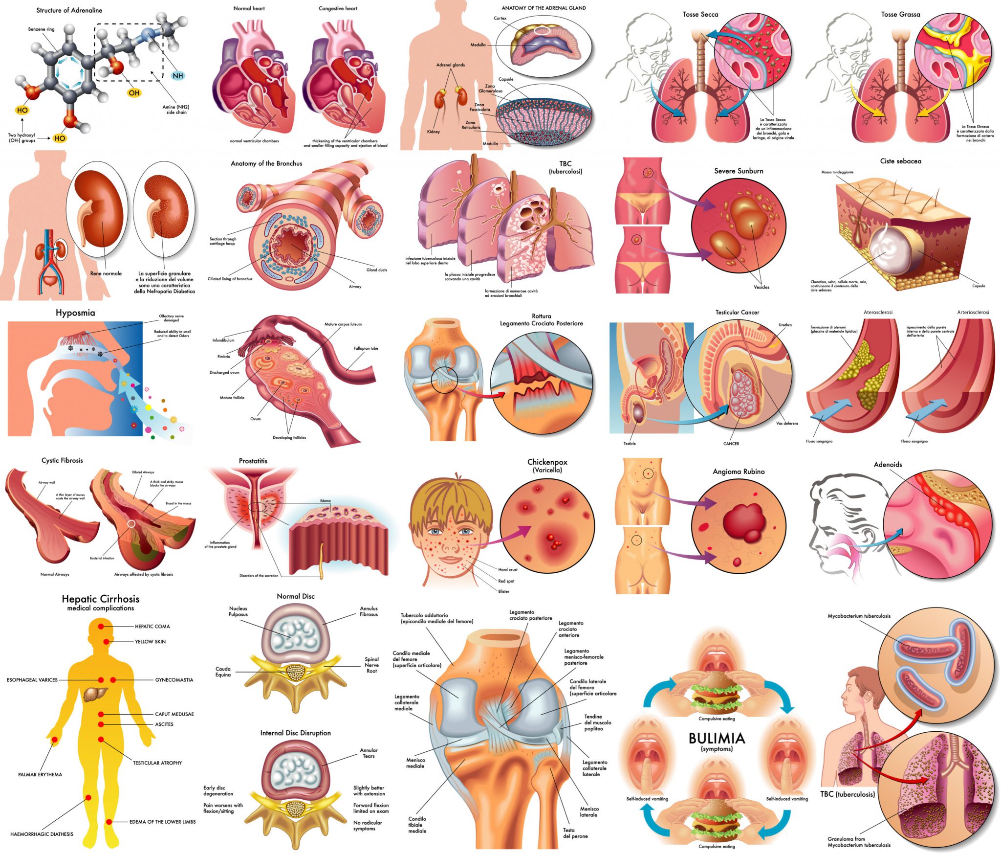 2048x1748 Illustrations Of Human Anatomy, Disease, Medical Topics Vector