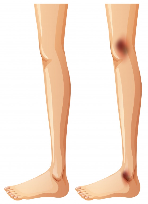 626x860 Legs Vectors, Photos And Psd Files Free Download