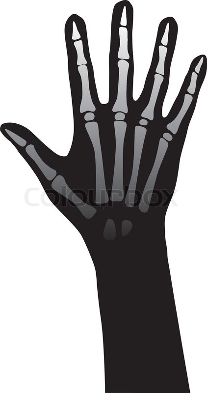 422x800 Open Hand Anatomy Vector Illustration On White Background Stock