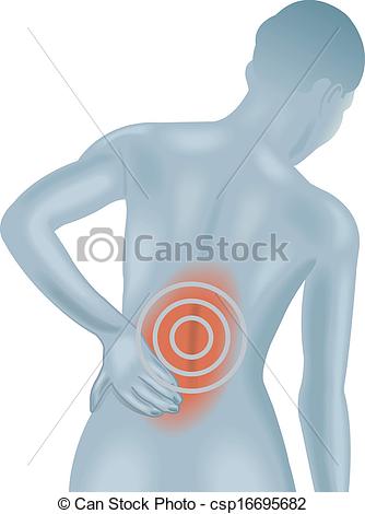 334x470 Medical Illustration Of Symptoms Of Back Pain.