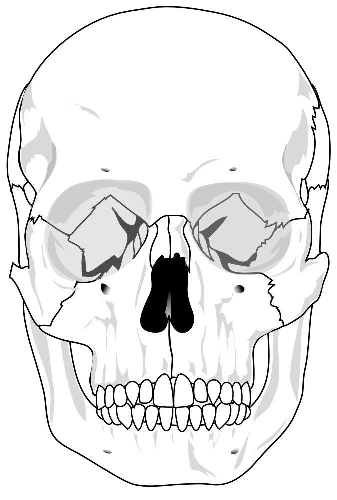 674x1000 Collection Of Free Vector Skull Digital. Download On Ubisafe