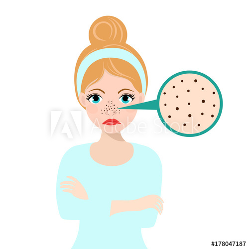 500x500 Unhappy Teen Girls Struggling With Acne. Skin Problems Solution