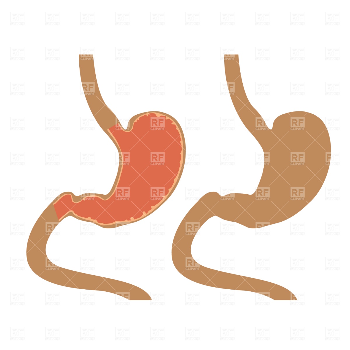 1200x1200 Stomach Vector Image Vector Artwork Of Healthcare, Medical
