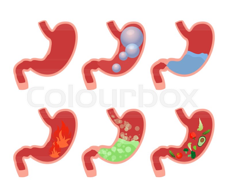800x671 Vector Illustration Cartoon Set Medical Illustrations Of Abdominal