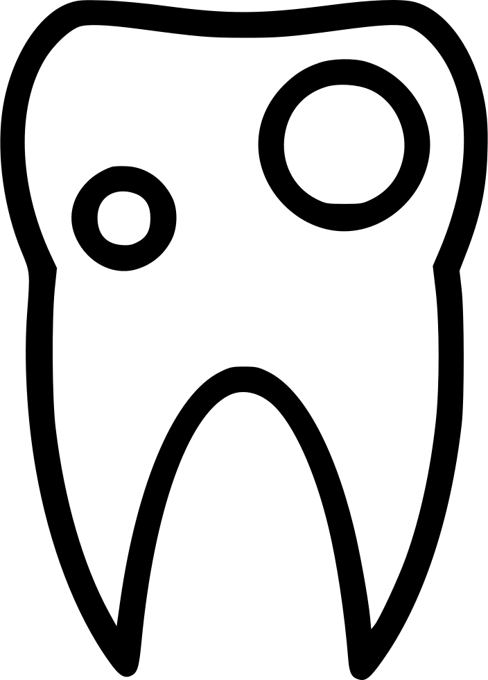 704x980 Collection Of Free Tooth Vector Cavity. Download On Ubisafe