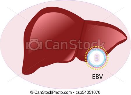 450x325 Mononucleosis Infection Vector Illustration On The White Background.