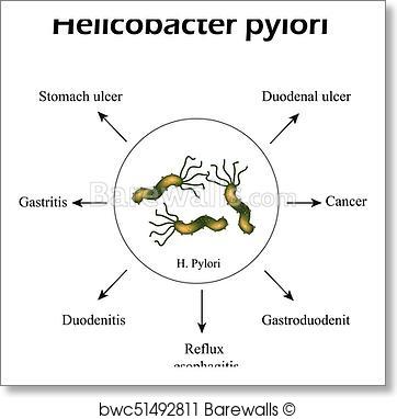 The best free Pylori vector images. Download from 4 free vectors of ...