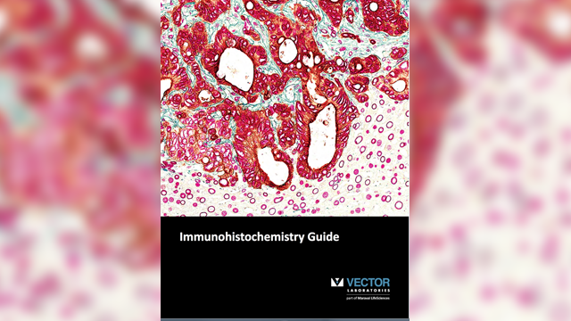 640x360 Vector Laboratories Publishes New Immunohistochemistry Guide