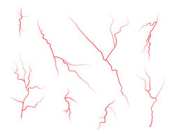 250x196 Set Of Human Eye Veins, Red Blood Vessels, Blood System. Vector