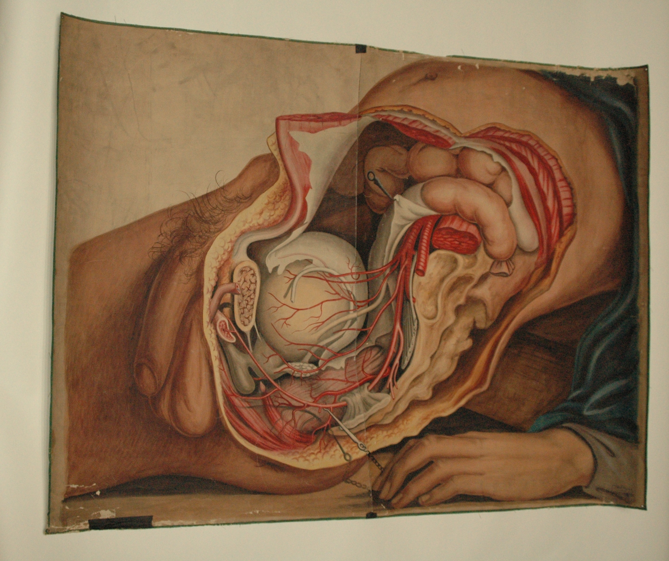 2331x1953 Teaching Watercolor Of Pelvic Organs And Arteries Of The Male Body