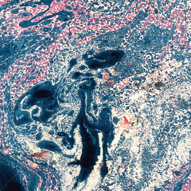 640x640 Gorgeous Textured Images Of Old Marbled Paper. Abstract Grunge